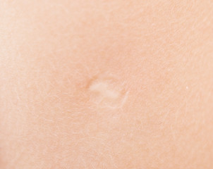 Image showing baby skin