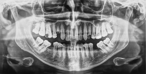 Image showing Medical Xray