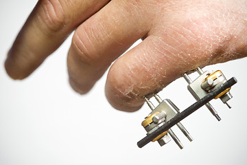 Image showing Exterior rig to support broken finger