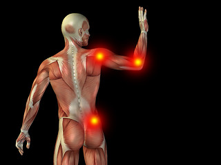 Image showing Conceptual human body anatomy pain on black