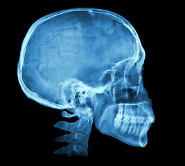 Image showing Human skull X-ray image