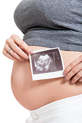 Image showing Pregnant woman displaying a prenatal ultrasound