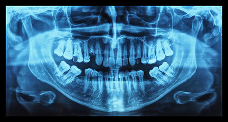 Image showing Medical Xray