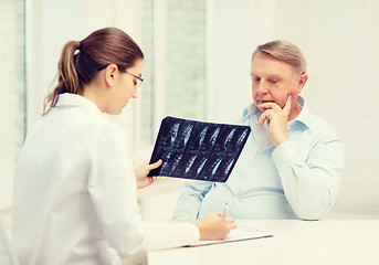 Image showing female doctor with old man looking at x-ray