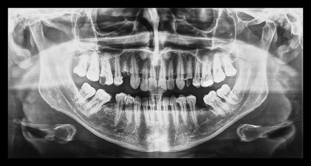 Image showing Medical Xray