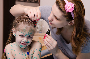 Image showing Mom plaster zelenkoj child with chickenpox sores