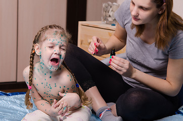 Image showing Girl suffering from chicken pox crying when my mother misses sores zelenkoj