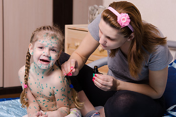 Image showing Girl suffering from chicken pox yells when my mother misses sores zelenkoj