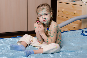 Image showing Little girl covered with green traces of chickenpox sitting on bed