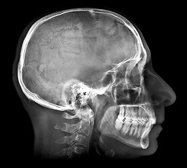 Image showing Human skull X-ray image