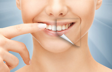 Image showing beautiful woman pointing to teeth