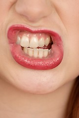 Image showing Woman's teeth