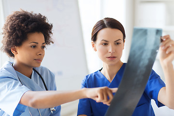 Image showing female doctors with x-ray image at hospital