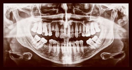 Image showing Retro look Medical Xray