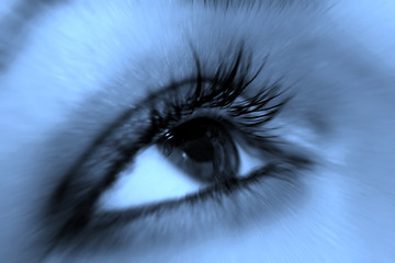 Image showing Black eye