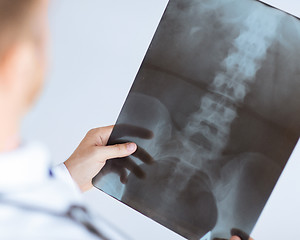 Image showing doctor holding x-ray or roentgen image