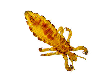 Image showing Pediculus humanus-body louse-lice