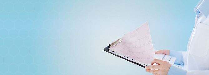 Image showing female doctor holding clipboard with cardiogram