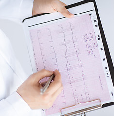 Image showing male doctor hands with cardiogram