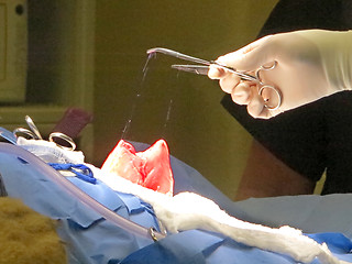 Image showing Stomach Suturing