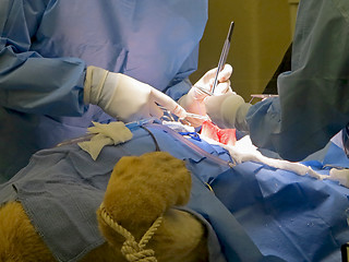 Image showing Stomach Suturing