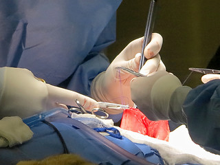 Image showing Stomach Suturing