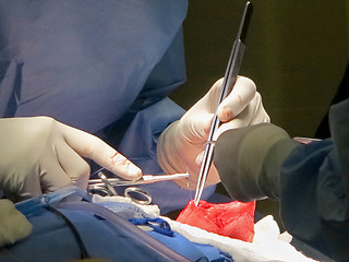 Image showing Stomach Suturing