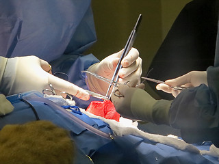 Image showing Stomach Suturing