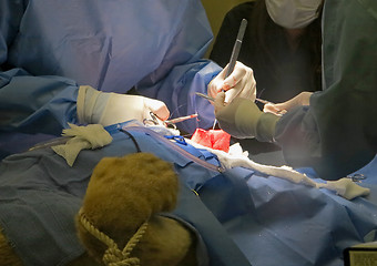 Image showing Stomach Suturing