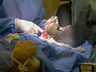 Image showing Stomach Suturing