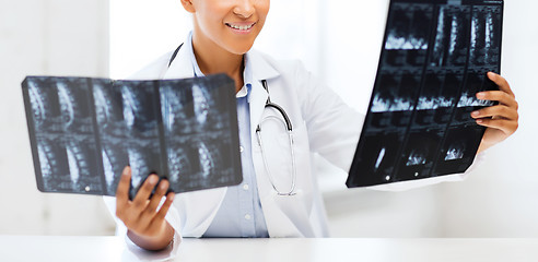 Image showing african doctor looking at x-ray