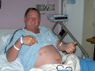 Image showing man in hospital after operation