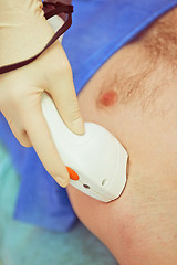 Image showing male laser epilation