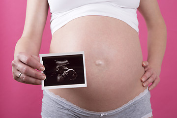 Image showing Closeup of a pregnant woman with an ultrasound picture in her ha