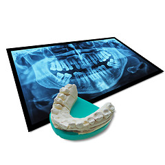 Image showing Xray of teeth with positive teeth cast