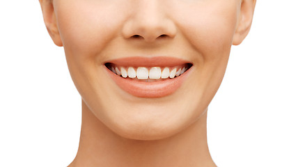 Image showing teeth whitening, before and after