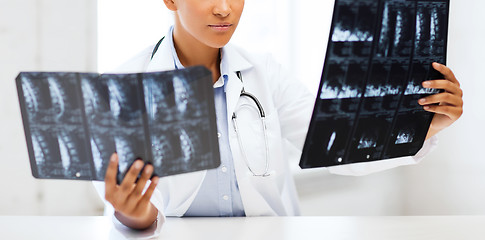 Image showing african doctor looking at x-rays