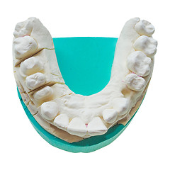 Image showing Positive teeth cast