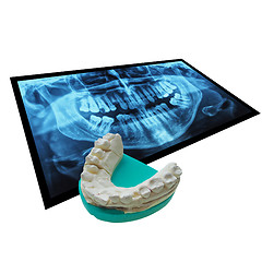 Image showing Xray of teeth with positive teeth cast