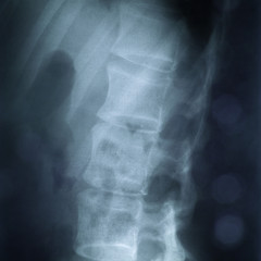 Image showing X-ray