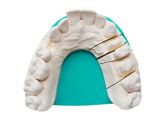 Image showing Positive teeth cast