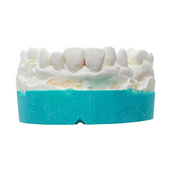 Image showing Positive teeth cast