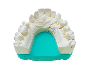 Image showing Positive teeth cast