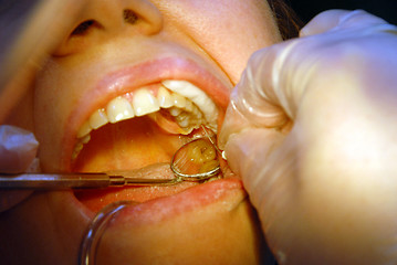 Image showing Patient in the dental clinic