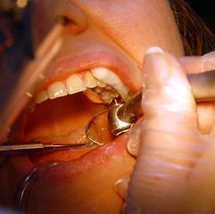 Image showing Patient in the dental clinic