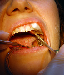Image showing Patient in the dental clinic