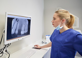 Image showing dentist with x-ray on monitor at dental clinic