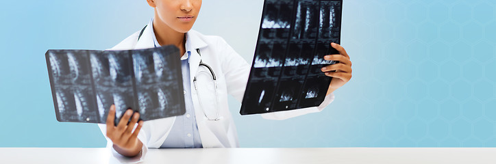 Image showing african american female doctor looking at x-rays