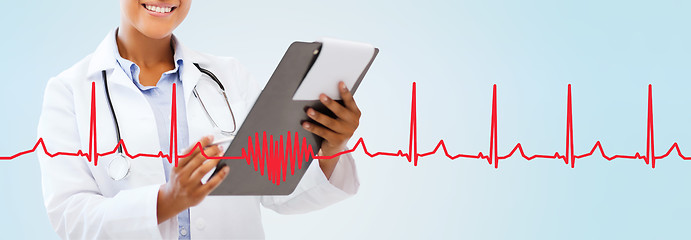 Image showing close up of smiling female doctor with clipboard