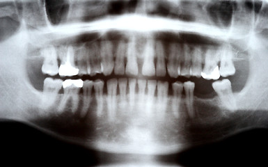 Image showing X-ray photograph